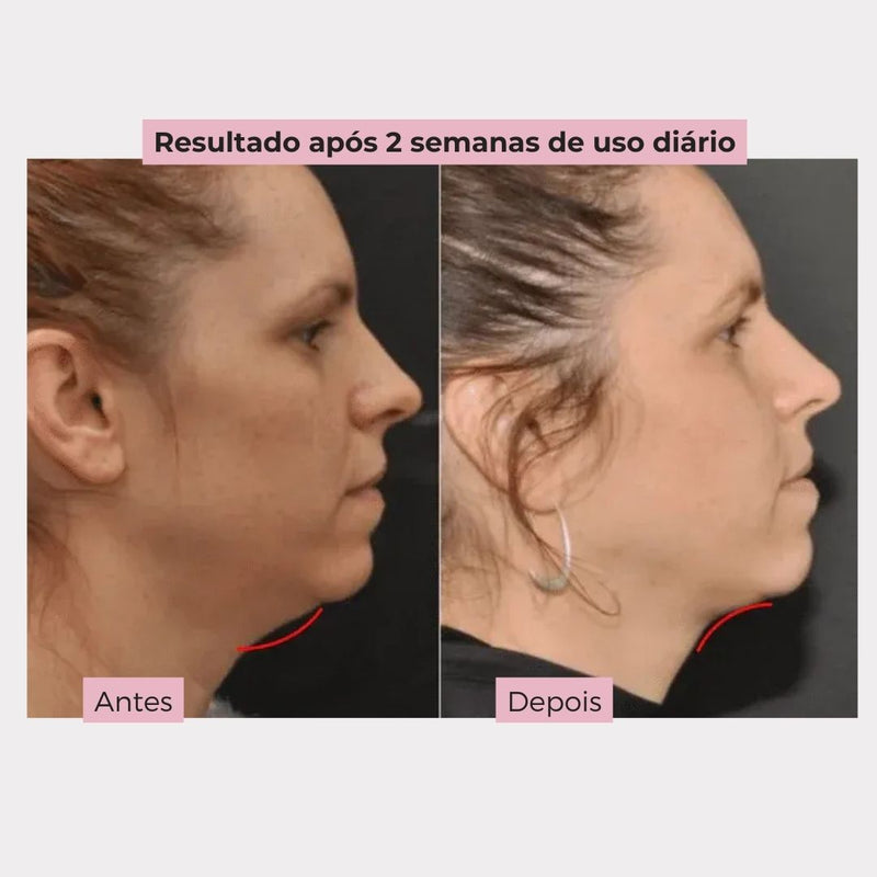 V- LiftUp - Máscara Coreana - Levanta o rosto, suaviza rugas e reduz papada [PROMO DE LANÇAMENTO]